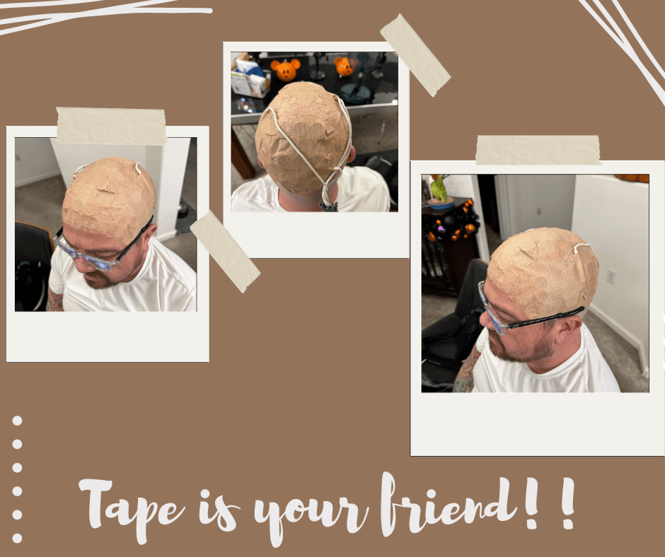 Can Optune Be Done by Yourself? - JohnVsGBM