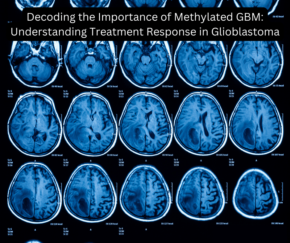 Decoding the Importance of Methylated GBM: Understanding Treatment Response in Glioblastoma - JohnVsGBM