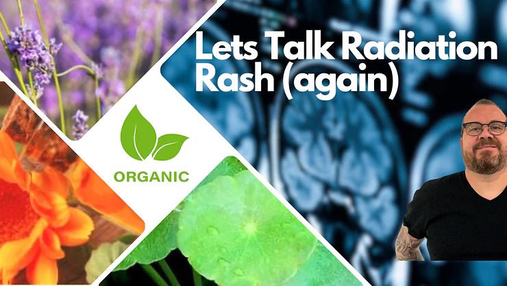 Let's Talk Radiation Rash (again) - JohnVsGBM