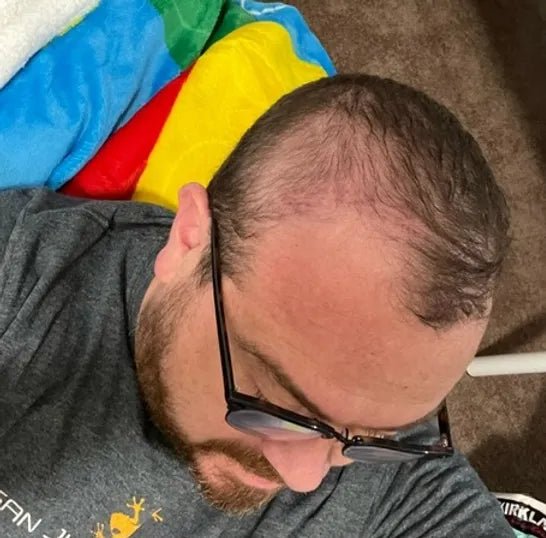 ANYTHING but the HAIR!! - JohnVsGBM